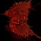 Preview: dSTORM of SLAH3 in HEK cells labeled with ATTO 655