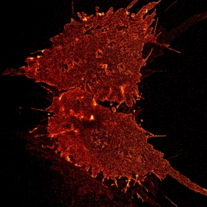 dSTORM of SLAH3 in HEK cells labeled with ATTO 655